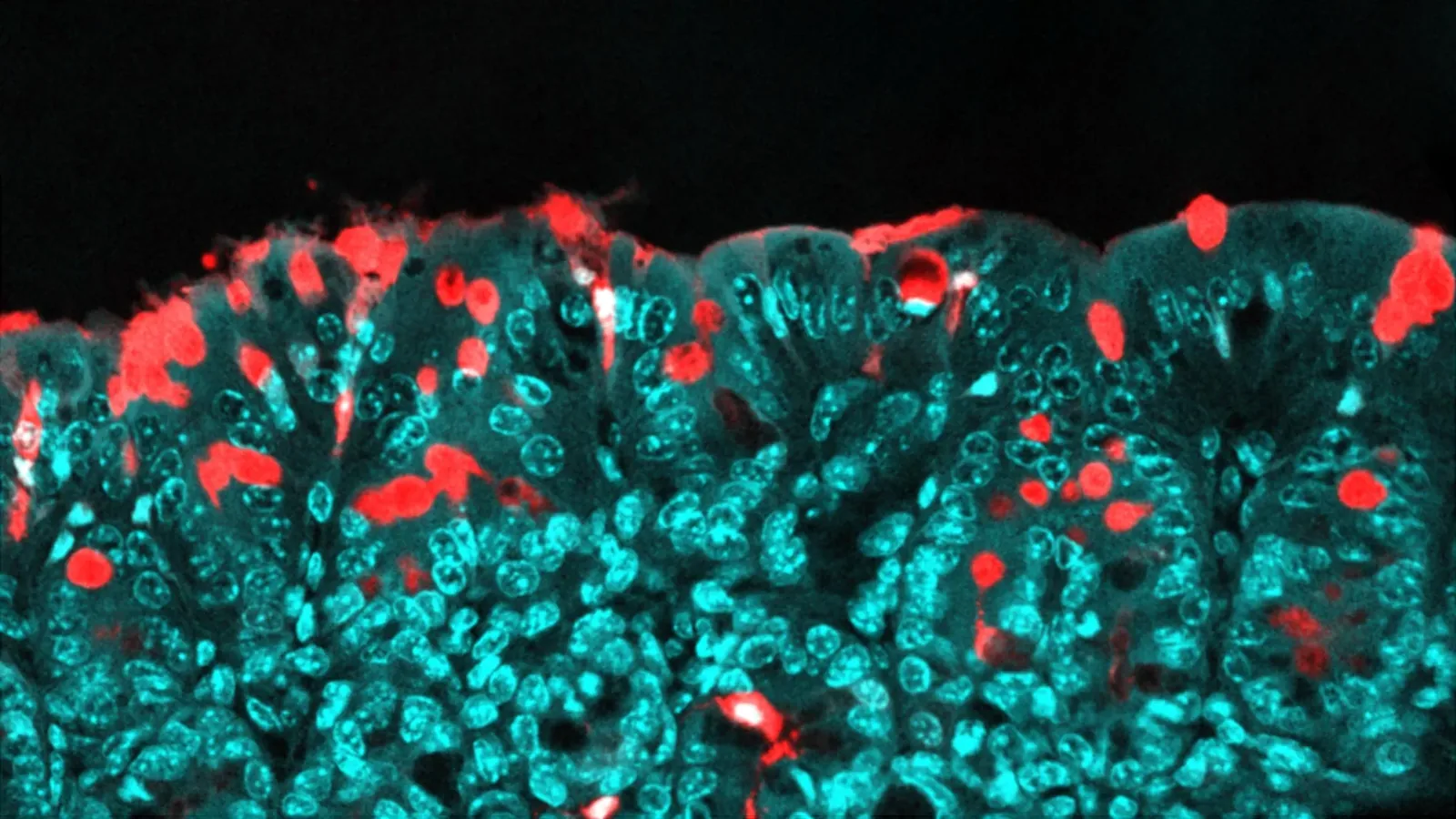 Common Food Emulsifiers’ Lifelong Impact on Kids’ Health